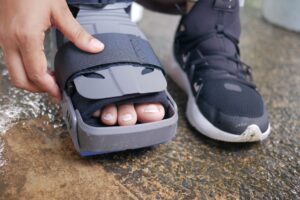 2nd, 3rd, and 4th Metatarsal Fracture Healing Time: What