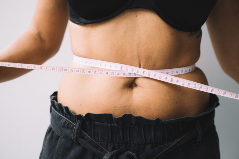 Acupuncture Weight Loss: Evidence, Points, and Real Results