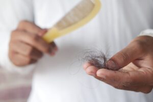 Alopecia Areata: Signs, Regrowth, and Treatment Options