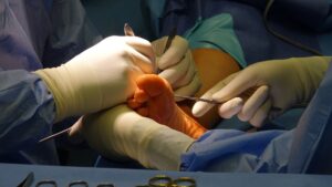 Big Toe Joint Pain: Causes, Treatment Exercises