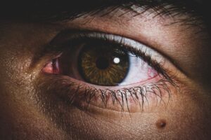 Bile Duct Obstruction: Causes, Symptoms, Treatment