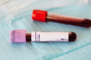 Blood Clots: Symptoms, Risks, Treatment, and Prevention