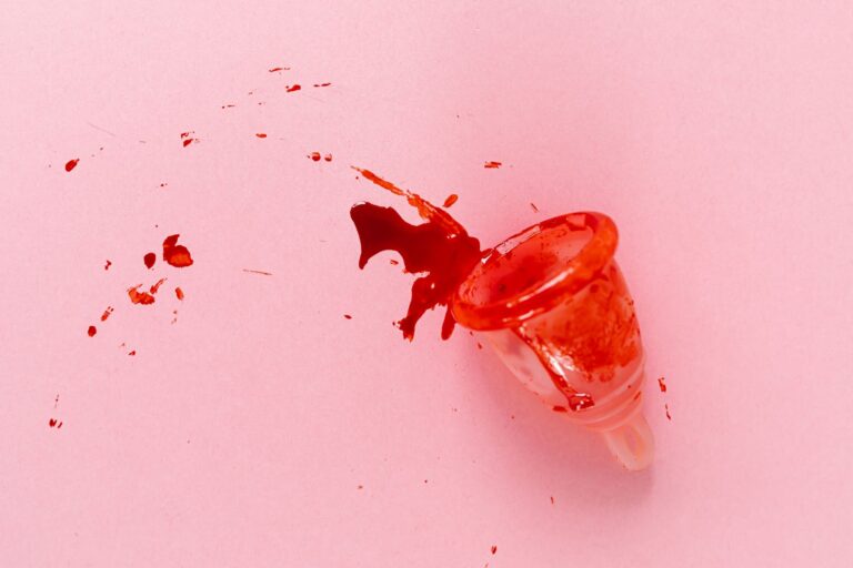 Blood Clots During Period: Causes, Natural Remedies