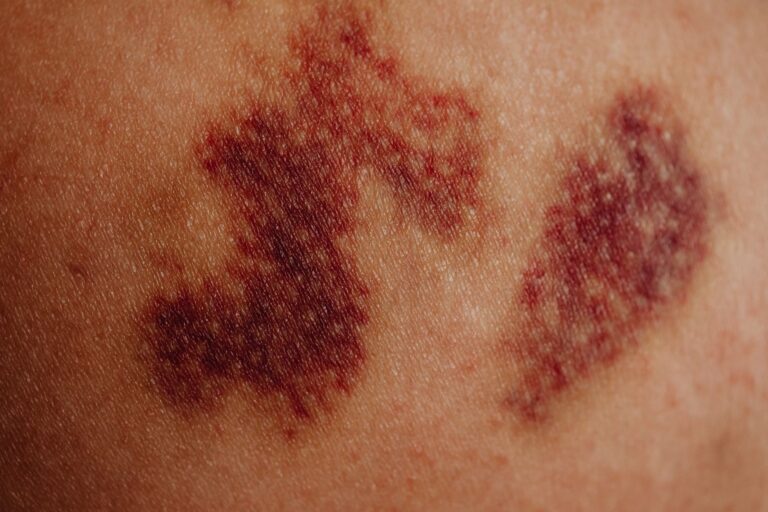 How Long Do Dermis Cuts Take to Heal? Timelines by Depth