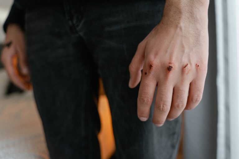 How Long Does A Scalp Wound Take to Heal? A Week-By-Week