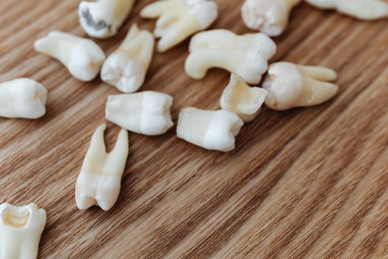 How to Extract a Molar at Home? Risks, Realities, and Safer