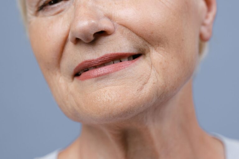 How to Get Rid of Marionette Lines Naturally? Smart At-Home
