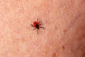 Lyme Disease: Symptoms, Treatment, and Prevention