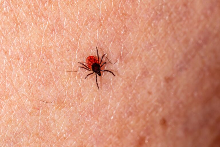 Lyme Disease: Symptoms, Treatment, and Prevention