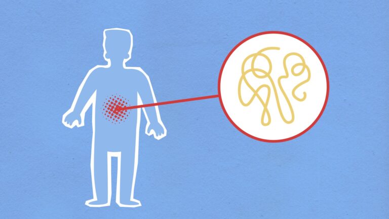 Signs Your Body Is Begging You to Quit Gluten: 9 Symptoms Worth