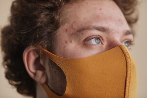 What Acne Locations Indicate about Your Health? A Zone-by-Zone
